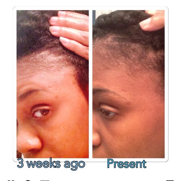 K.N.O.T.T.Y Gurl’s Grow Me Oil 2oz - Picture 4 of 7